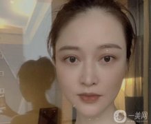 我見到了醫(yī)生，醫(yī)生給我開了外切去眼袋手術(shù)