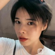 現(xiàn)在可以看到恢復(fù)得相當(dāng)不錯(cuò)，整個(gè)臉真的是越來(lái)越有立體感了