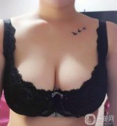 在嚴(yán)重的情況下對(duì)女性泌乳后期也有一定的影響，所以副乳切除是重要的