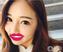 個(gè)人覺得太陽穴比較凹陷，臉頰不夠飽滿，總給人一種干燥的感覺，特別沒精打