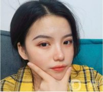 我終于下定決心做雙眼皮了，其實(shí)我想了很久，挑了很多醫(yī)院，看了很多案例，