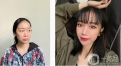 雖然我的眼睛在單眼皮里應該比較大，雖然大，但是沒有層次感