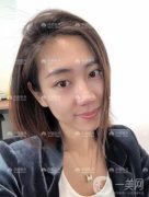 雖然現(xiàn)在做雙眼皮手術(shù)不是什么大手術(shù)，甚至可以說十有八九做了雙眼皮