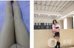 抽脂已經(jīng)快四個月了，效果還是很棒的!以前不能穿的褲子現(xiàn)在可以輕松拿了