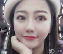 手術(shù)前鼻子不高，總覺(jué)得鼻子不好看