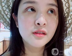 一定要特別注意雙眼皮的恢復(fù)期，說(shuō)怎么剪雙眼皮的睫毛，怎么讓睫毛更長(zhǎng)更密