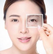 從厭世臉到貓系女，眼睛的美麗與困擾