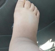 水療教授分享：改良水腫、干燥、脫發(fā)的泡澡秘訣