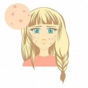 痘印已經(jīng)變黑了怎么辦