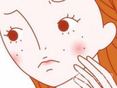 3天快速淡化黑色痘印