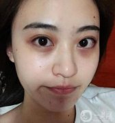 熬夜一時爽，一直熬夜顏值暴跌！拯救你的肌膚，告別“節(jié)后焦慮”