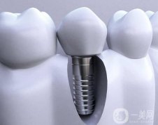 襄陽(yáng)種牙多少錢一顆??？種植體品牌+價(jià)格介紹，口碑醫(yī)院推薦
