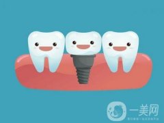 溫州種植牙一顆要多少錢？價(jià)格收費(fèi)標(biāo)準(zhǔn)/正規(guī)牙科機(jī)構(gòu)一覽