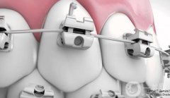 常州牙齒矯正多少錢？價(jià)目表更新，附上三家口碑醫(yī)院參考