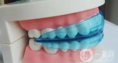 大連牙齒矯正大概要花費多少錢？收費標準+正規(guī)牙科機構(gòu)一覽