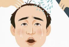 植發(fā)費用大揭秘：這些因素讓你不花冤枉錢！