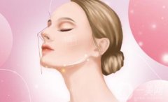 膨體隆鼻的詳細(xì)流程及護(hù)理要點(diǎn)