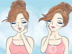 去眼袋后如何緩解疼痛