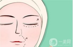 全切與埋線雙眼皮手術有何優(yōu)缺點？