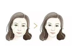 顴骨手術失敗應該怎么修復