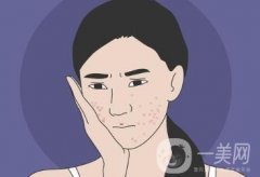 人造酒窩什么時(shí)候可以恢復(fù)？