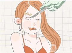 微創(chuàng)雙眼皮手術的特點是什么