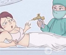 吸脂手術效果好嗎，哪些人適合做