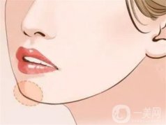 下巴注射玻尿酸需要注射多少次