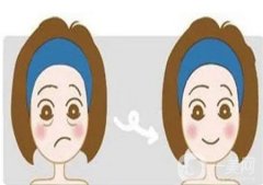 懸吊提升除皺手術的優(yōu)勢有哪些