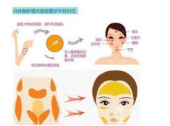 自體脂肪豐胸需要做多少次手術(shù)？