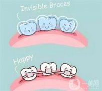 牙齒矯正的設(shè)備有哪些