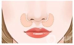 有哪些鼻整形術(shù)的常見方法