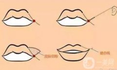 有哪些因素決定漂唇的維持時間？