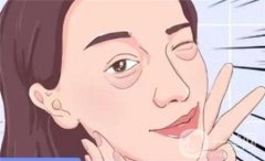 針對不同類型的腫泡眼的方法