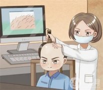 植發(fā)的風(fēng)險有哪些