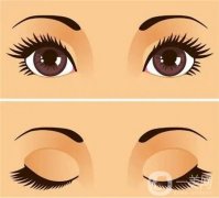 做雙眼皮手術(shù)的風(fēng)險(xiǎn)有哪些？
