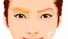 常見眉弓整形方法有哪些呢？