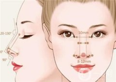 不適合隆鼻的人群有哪些