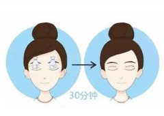 不同方式做雙眼皮的費(fèi)用