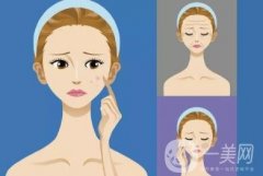 光子嫩膚效果是否持久，是否會留下疤痕