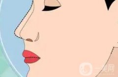 硅膠隆鼻怎么樣，可以取出嗎