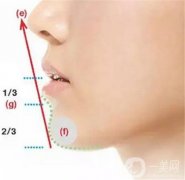 雙下巴線(xiàn)雕的步驟是怎樣的