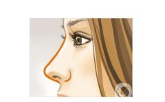 鼻骨矯正有哪些常用的方法