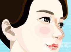 鼻部整形術(shù)后的恢復(fù)時間及注意事項