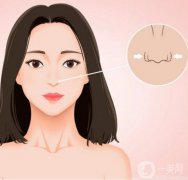 鼻孔縮小手術(shù)是否安全？是否有風險