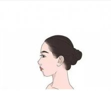 不適合隆鼻的人群有哪些