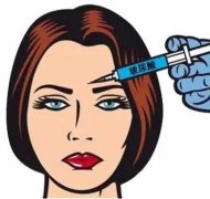 玻尿酸適用于哪些部位呢？