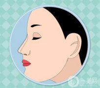 鼻綜合感染的應(yīng)對(duì)與預(yù)防措施