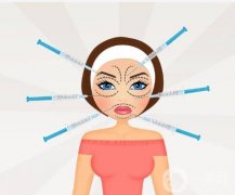 玻尿酸去除皺紋究竟需要多久才能見效