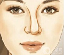 鼻整形失敗修復有哪些注意事項